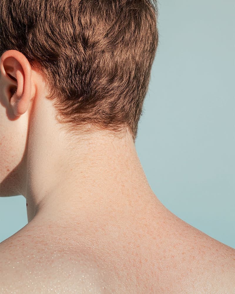 Regenerative Hair Transplant