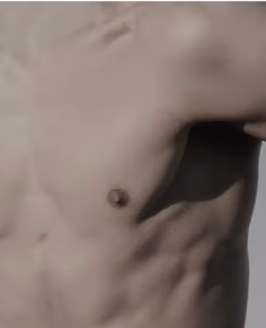 Body Regenerative Surgery