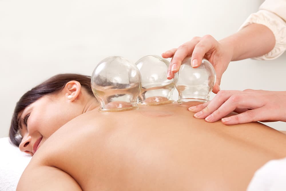 Cupping Therapy: The Holistic Massage