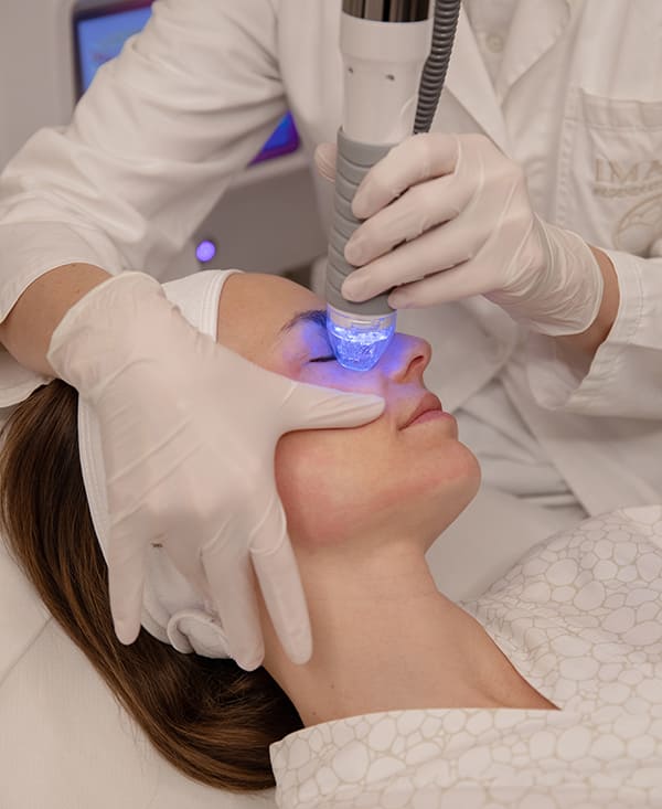 Microneedling with High Fractional Radiofrequency
